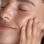 melasma, lentigos solares y pecas