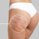 Skin Care Center - Heredia