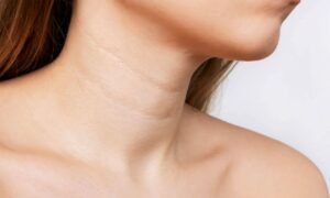 Inicio 7 Cuidado de la piel del cuello y escote para prevenir el envejecimiento prematuro